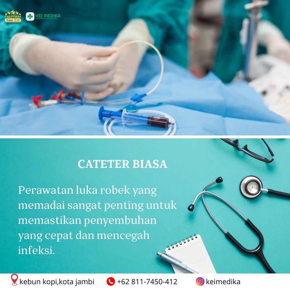 CATETER BIASA 