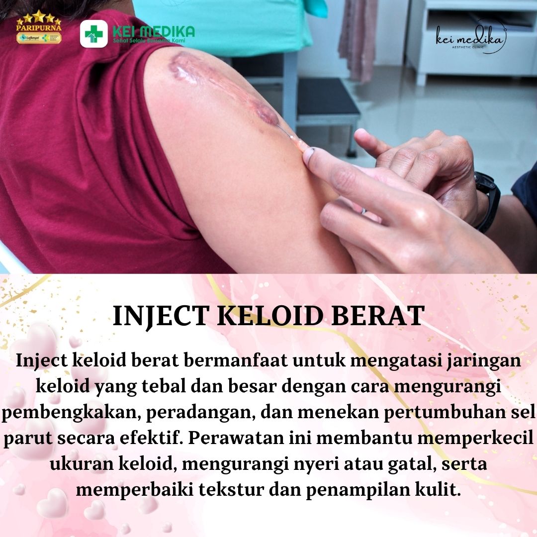 INJECT KELOID BERAT