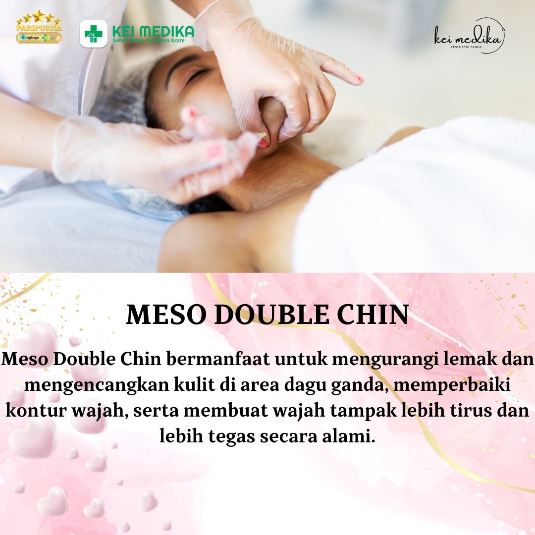 MESO DOUBLE CHIN