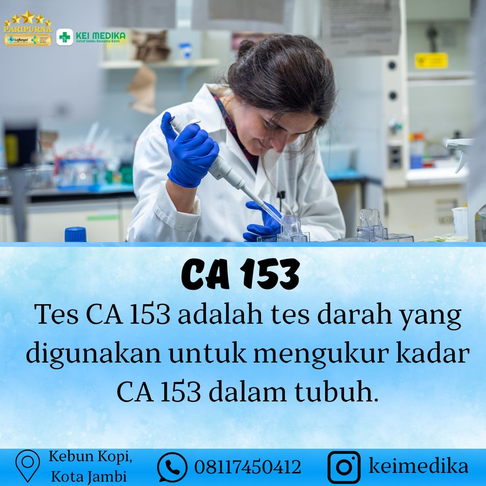 CA 153