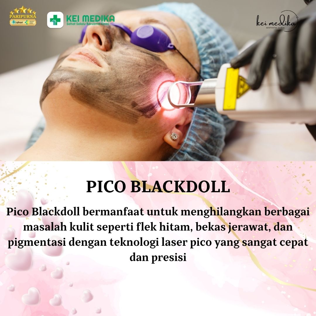 PICO BLACKDOLL