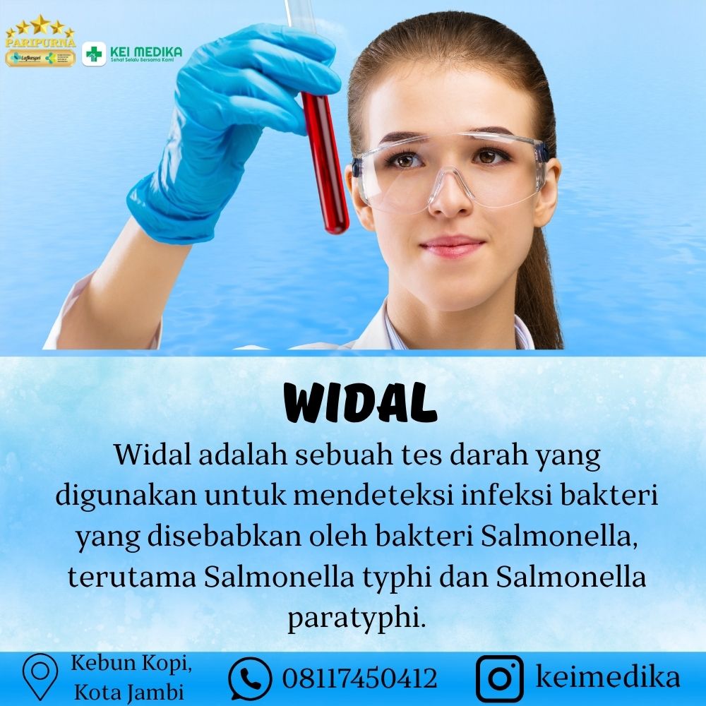 WIDAL 