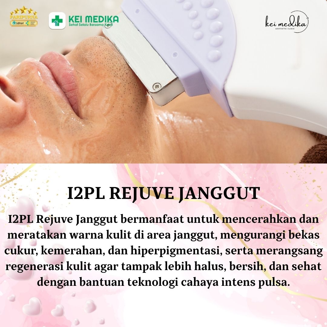 I2PL REJUVE JANGGUT