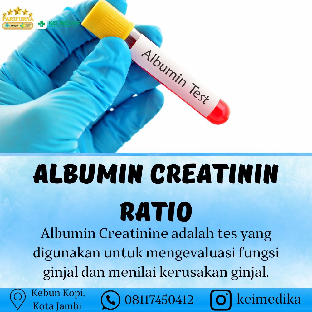 ALBUMIN CREATININ RATIO